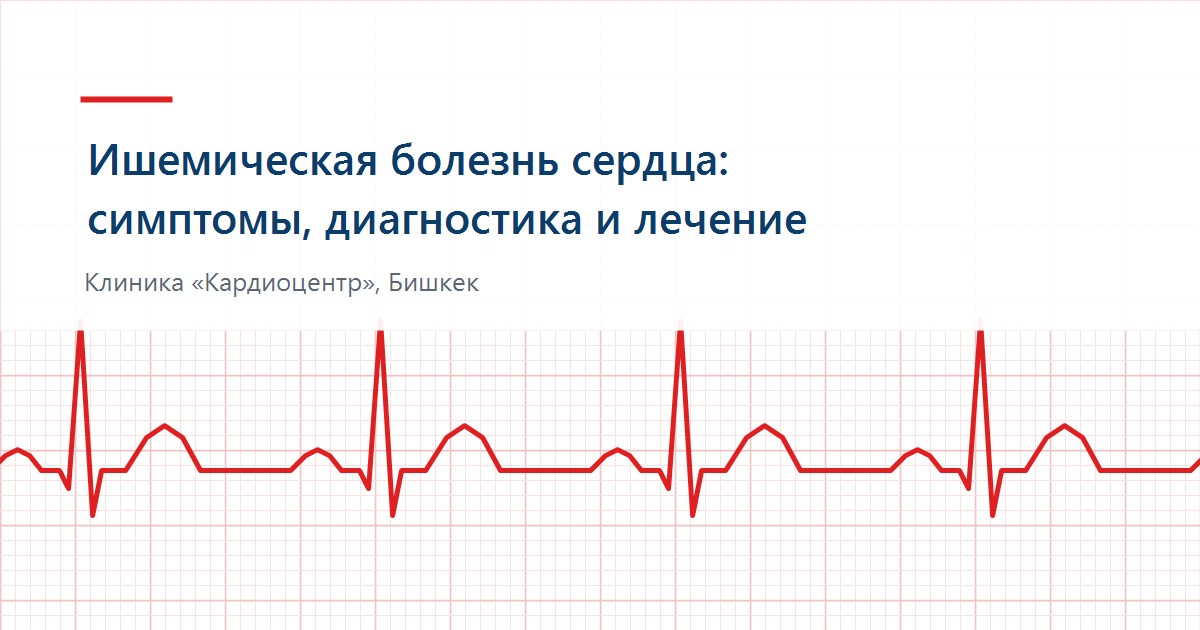ЭКГ при ишемической болезни сердца — клиника Кардиоцентр, Бишкек